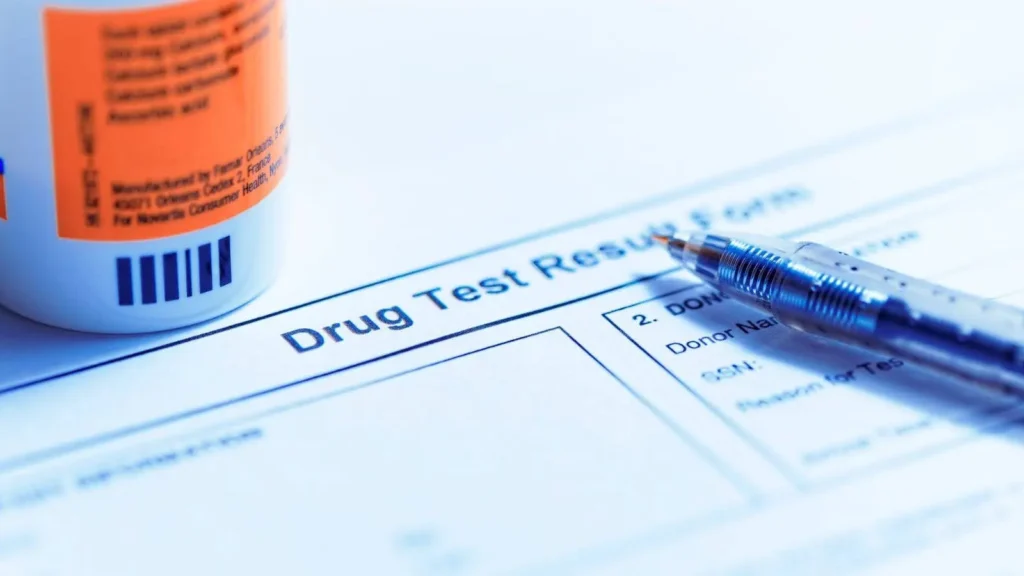 Erba legale e analisi cosa risulta davvero nei test